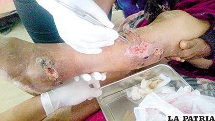 Heridas infectadas en la paciente atacada por un can /LA PATRIA