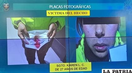 La funcionaria tras una intervención policial, fue agredida por un ebrio /Policía
