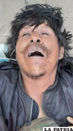 El fallecido no fue identificado