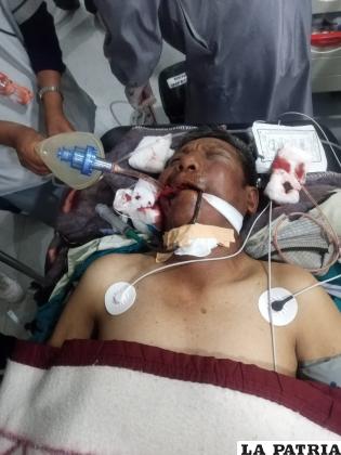 La víctima se encuentra hospitalizada tras el atropello /Tránsito 