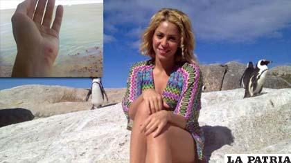Shakira sufrió una lesión provocada por un león marino