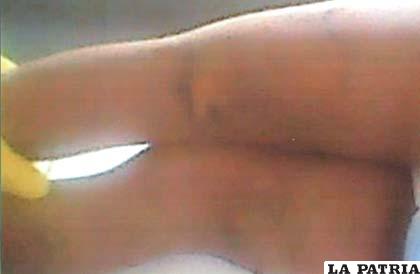 En las piernas del niño se evidencia el constante maltrato físico