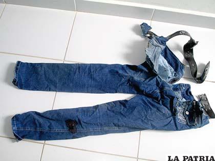 El pantalón que utilizaba la 
víctima el día 
de su agresión