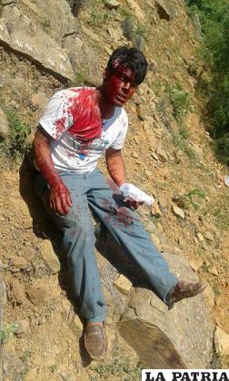 Uno de los heridos durante el accidente