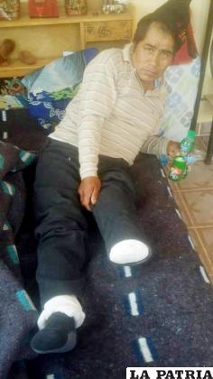 Uno de los pilares de la familia Mamani Velasco perdió una pierna / LA PATRIA