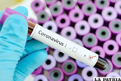 Los estudios en el joven continúan para verificar si es o no coronavirus /Imagen referencial
