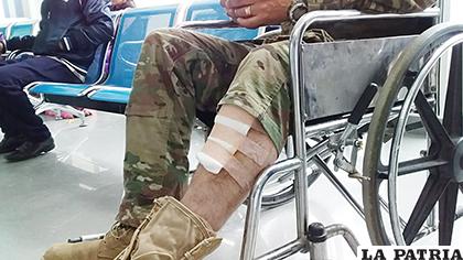 El militar muestra la pierna como prueba de la herida a causa de un proyectil de arma de fuego /LA PATRIA