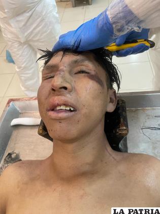 Piden a familiares y conocidos, poder reconocer al ahora occiso /Cortesía