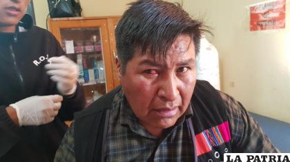 La víctima presentó daños en la cabeza y el ojo derecho /LA PATRIA