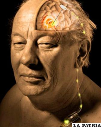 La aplicación de una corriente eléctrica de bajo voltaje podría ayudar a personas que sufrieron derrame cerebral