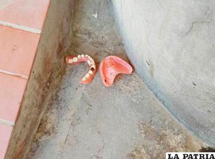 Las placas dentales que se encontraron en el lugar