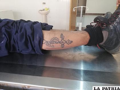 Piden a la ciudadanía identificar al hombre fallecido. Como referencia tiene un tatuaje en la pierna /LA PATRIA