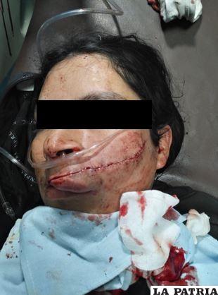 La víctima fue hospitalizada tras la herida provocada por el sindicado 
/Policía