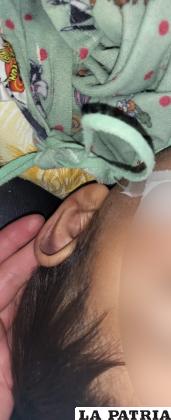 La víctima viene recuperándose de las heridas que le provocó su padrastro /LA PATRIA
