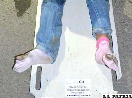 Los pies de la muchacha quedaron así, producto del arrastre
