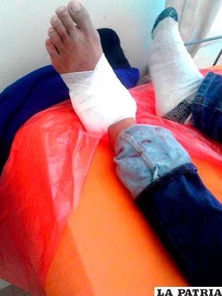 El pie herido del adolescente