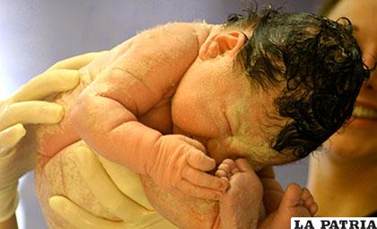 La ictericia en la mayoría de los casos no es tan nociva para los recién nacidos /www.multimedica.com.gt