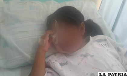 Niña mejora pero requiere ayuda económica para no tener cicatrices en el rostro /SEDES 