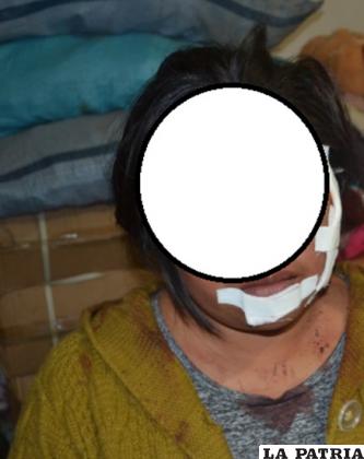 La víctima tiene cortes en la cara /Policía
