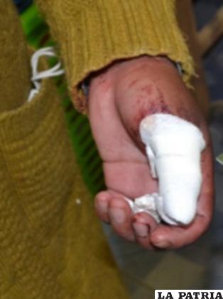 Sufrió cortes en el pulgar de su mano izquierda 
/Policía