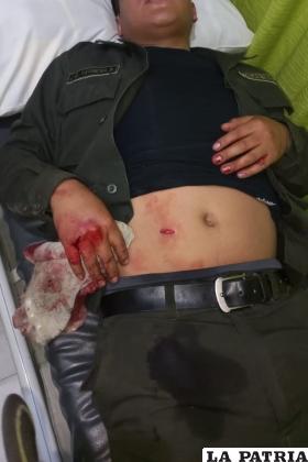 Dos efectivos policiales resultaron con lesiones por arma punzocortante /LA PATRIA