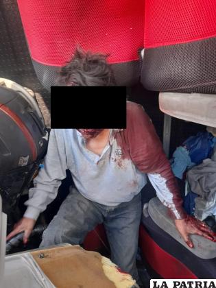 El conductor tiene heridas de gravedad /Cortesía