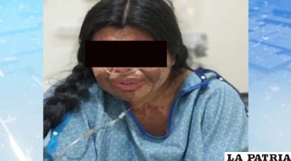 Matilde Jiménez cuando estaba internada en el hospital Viedma de Cochabamba /RR.SS.