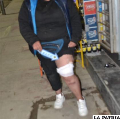 La víctima sufrió una herida en la pierna izquierda /Cortesía