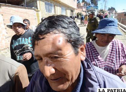 Choferes y vecinos se enfrentaron en Pasankeri, La Paz y cinco personas resultaron heridas (Foto APG)