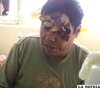 Félix Chulgar con heridas en la frente denunció golpiza y robo