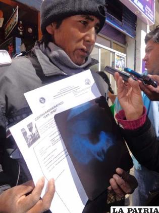 Chipaya agredido muestra radiografía de la fractura de su nariz