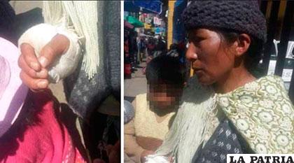 La mujer agredida reclama justicia /El Policial Bolivia