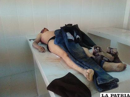 El cuerpo del trabajador de EMAO en la morgue del Cementerio General