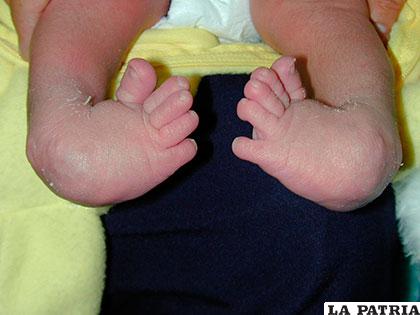 Profesionales en Oruro fueron capacitados para atender casos de pie zambo en niños /www.clinicadetrauma.com