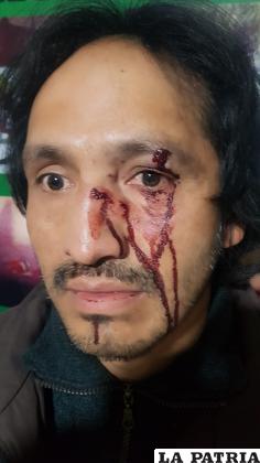 Javier Zambrana Sierra, víctima de golpes / LA PATRIA