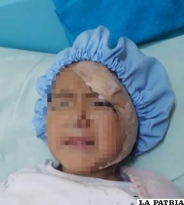 Niña sufrió agresiones al nivel de la ceja /Sedes