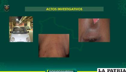 La víctima sufrió varias heridas / Policía