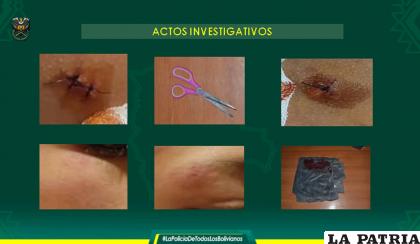 Las heridas de la víctima /cortesía
