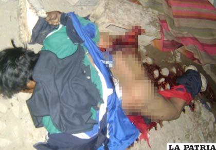 El sujeto perdió su pierna derecha