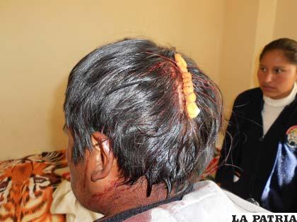 Uno de los heridos que llegó al hospital luego de una golpiza