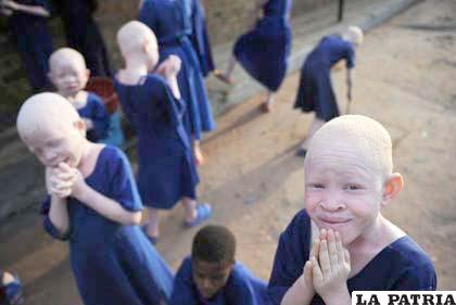 En África los nacidos albinos sufren una cruel persecución