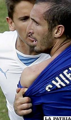 El jugador italiano Giorgio Chiellini muestra las marcas de los dientes
