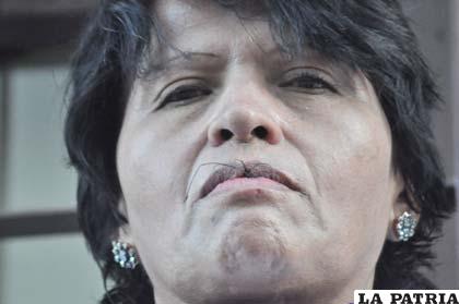 Junet Ojeda con los labios cosidos
