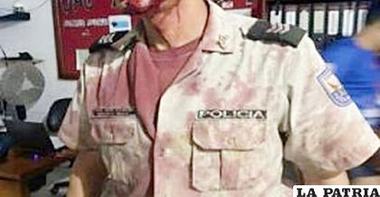 Uno de los policías fue agredido con una piedra /ÚLTIMA HORA
