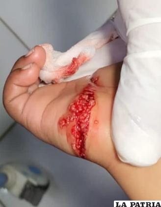 Niño fue mordido por un mono en la mano derecha 
/SEDES
