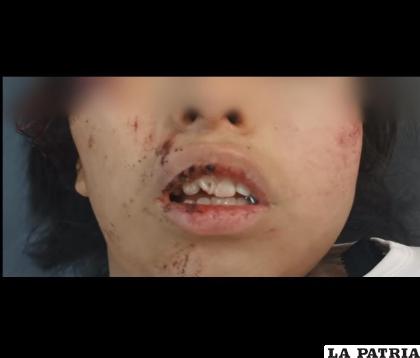 La víctima sufrió trauma facial tras caer de la movilidad /DIO
