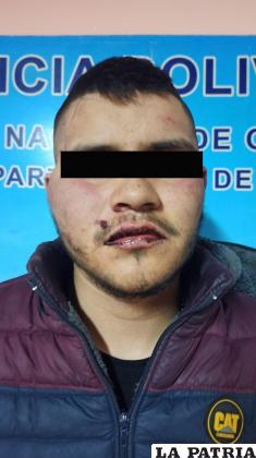 El inmigrante fue golpeado durante el hecho /Policía