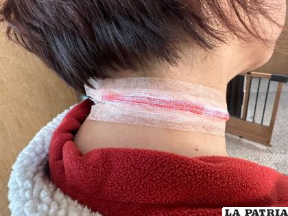 La víctima sufrió un corte en el cuello /Referencial
