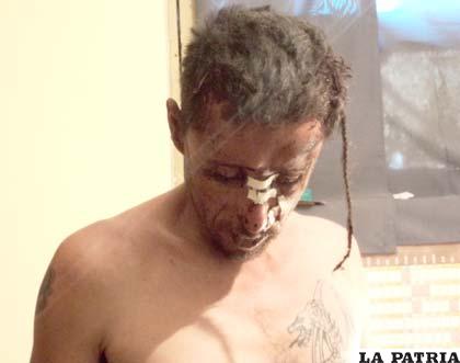 La cabeza de Renato presentaba varias heridas