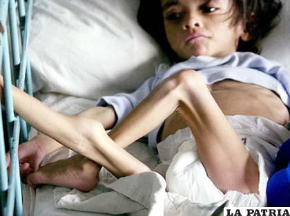 Entre 1.000 y 15.000 niños menores de cinco años están en riesgo de morir en Guatemala debido a la desnutrición aguda